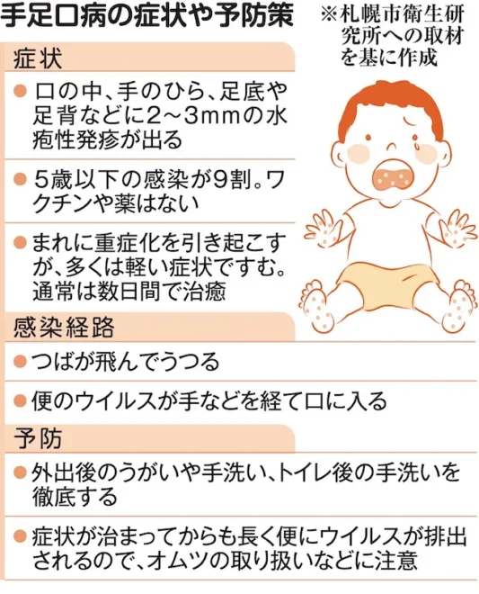 札幌市内で「手足口病」流行続く　警報基準上回る